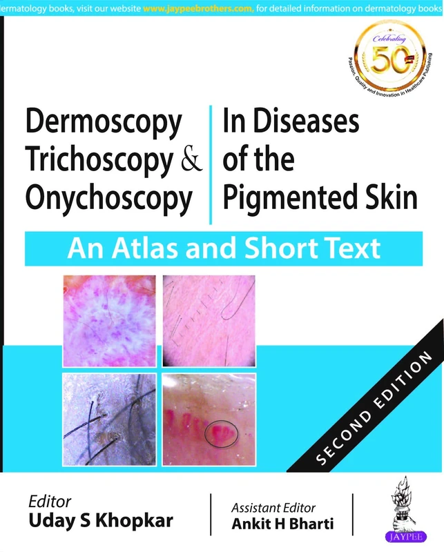 Dermoscopy, Trichoscopy and Onychoscopy in Diseases of the Pigmented Skin: An Atlas and Short Text