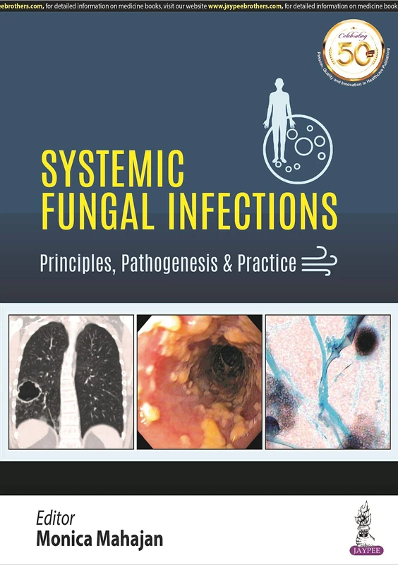 Systemic Fungal Infections: Principles, Pathogenesis & Practice