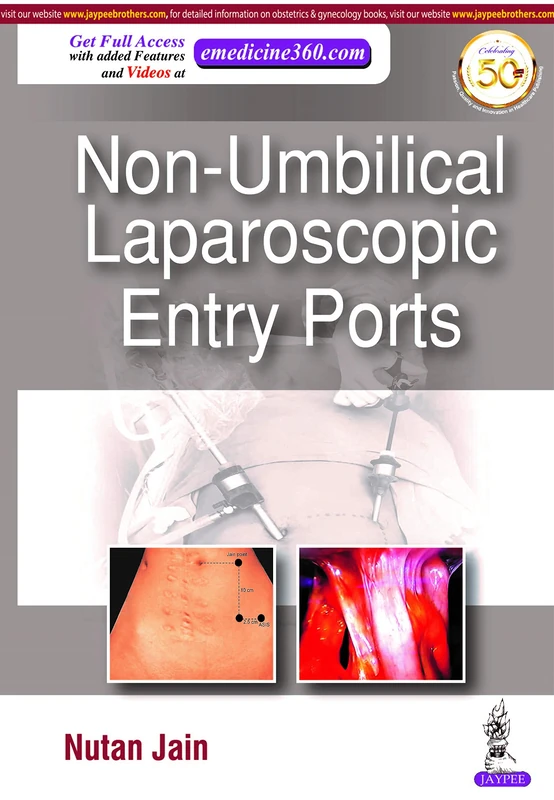Non-Umbilical Laparoscopic Entry Ports