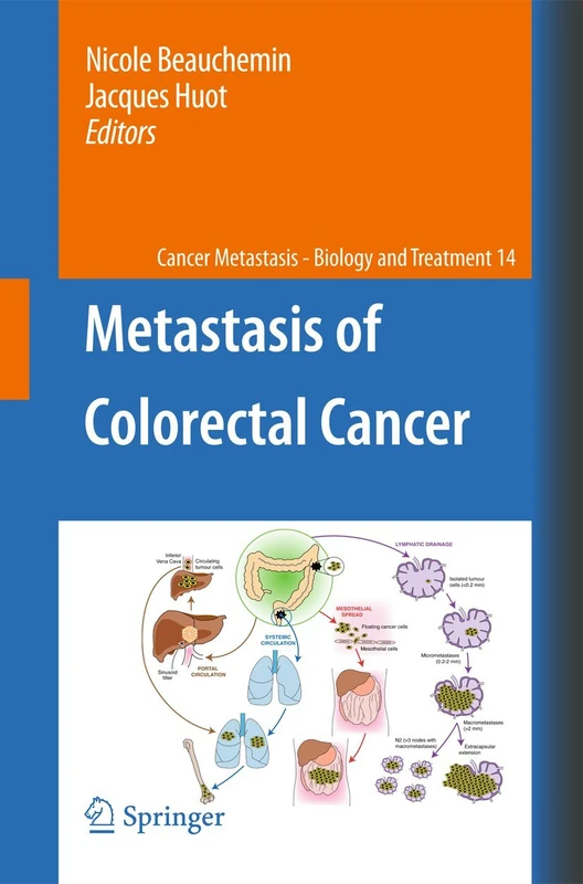 Metastasis of Colorectal Cancer: 14 (Cancer Metastasis - Biology and Treatment, 14)