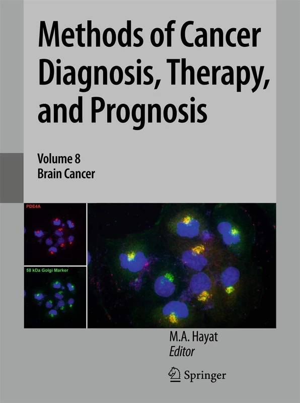 Methods of Cancer Diagnosis, Therapy, and Prognosis: Brain Cancer: 8