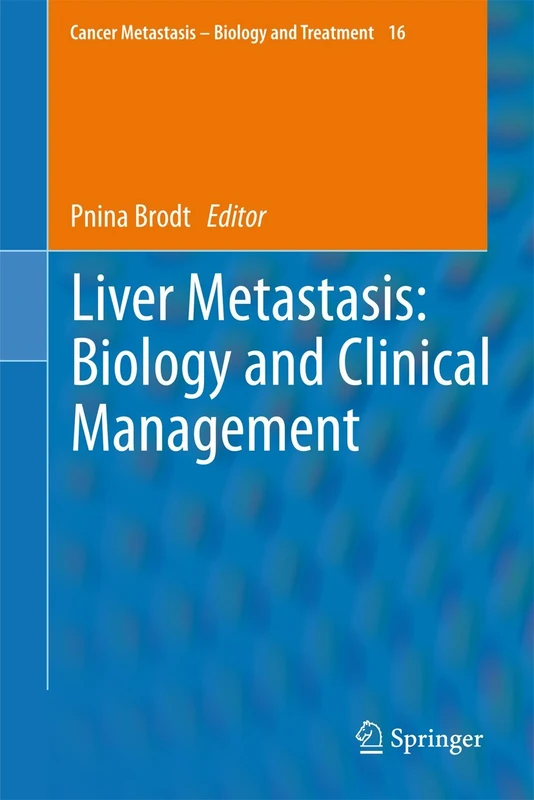 Liver Metastasis: Biology and Clinical Management: 16 (Cancer Metastasis - Biology and Treatment, 16)