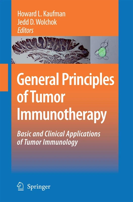 General Principles of Tumor Immunotherapy: Basic and Clinical Applications of Tumor Immunology