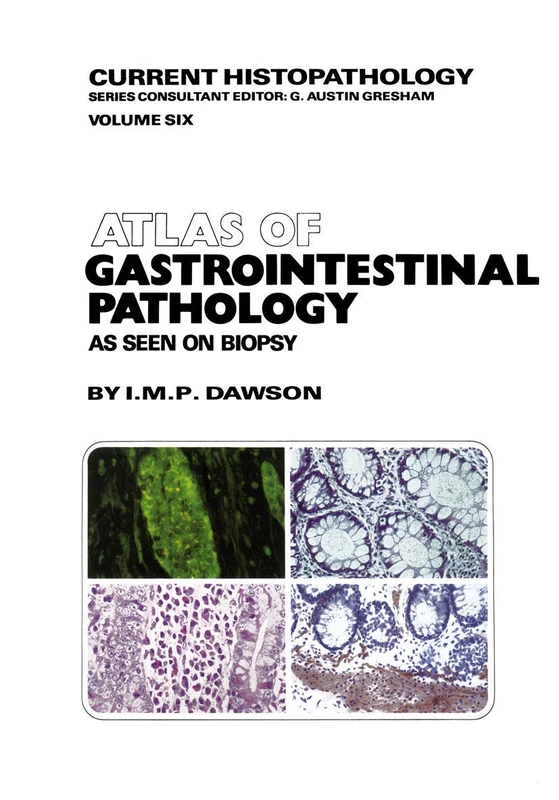 Atlas of Gastrointestinal Pathology: As Seen on Biopsy: 6 (Current Histopathology, 6)