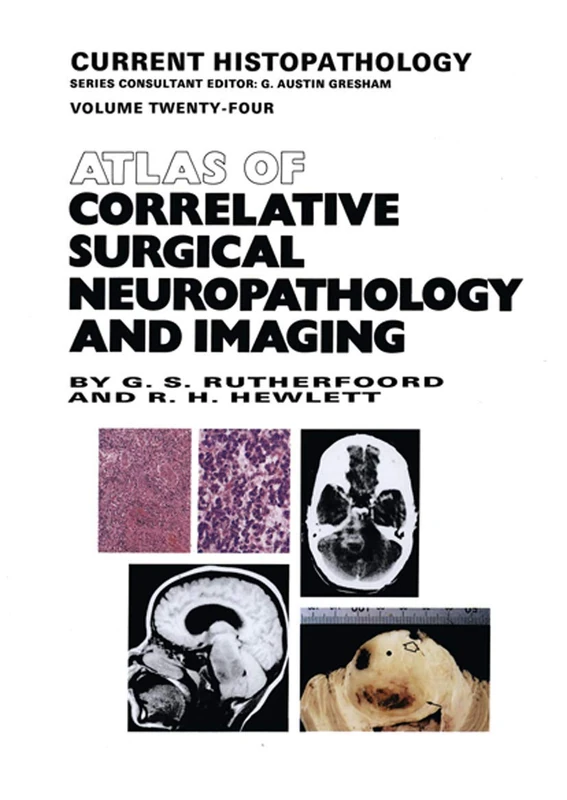 Atlas of Correlative Surgical Neuropathology and Imaging: 24 (Current Histopathology, 24)