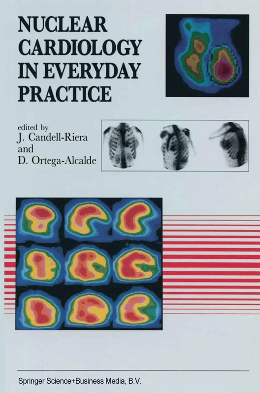 Nuclear Cardiology in Everyday Practice: 146 (Developments in Cardiovascular Medicine, 146)