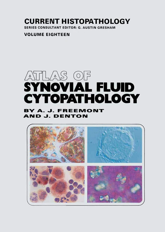 Atlas of Synovial Fluid Cytopathology: 18 (Current Histopathology, 18)