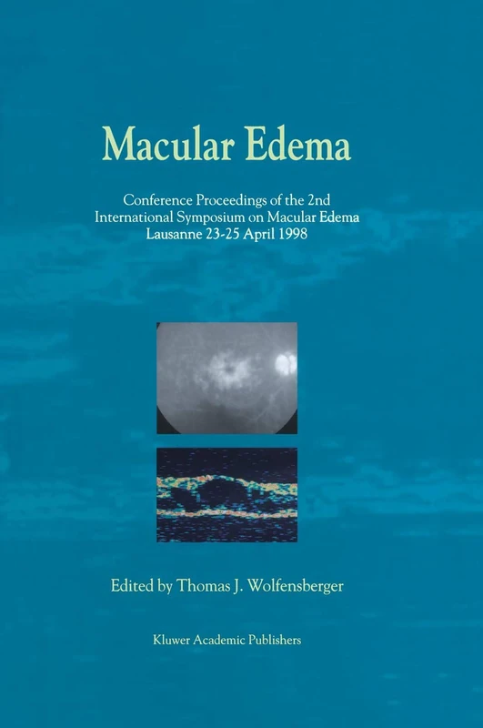 Springer Macular Edema - 2nd International Symposium Proceedings