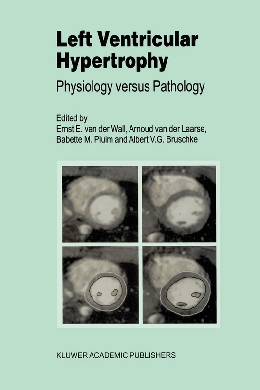 Left Ventricular Hypertrophy: Physiology versus Pathology: 223 (Developments in Cardiovascular Medicine)