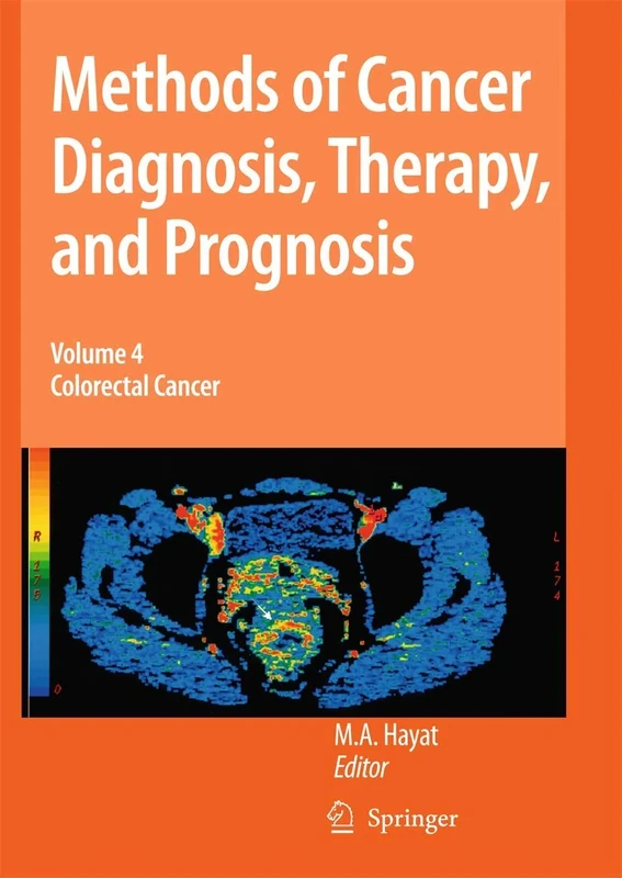 Methods of Cancer Diagnosis, Therapy and Prognosis: Colorectal Cancer: 4