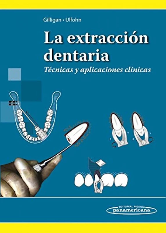 La extracción dentaria / Tooth extraction: Técnicas Y Aplicaciones Clínicas / Techniques and Clinical Applications