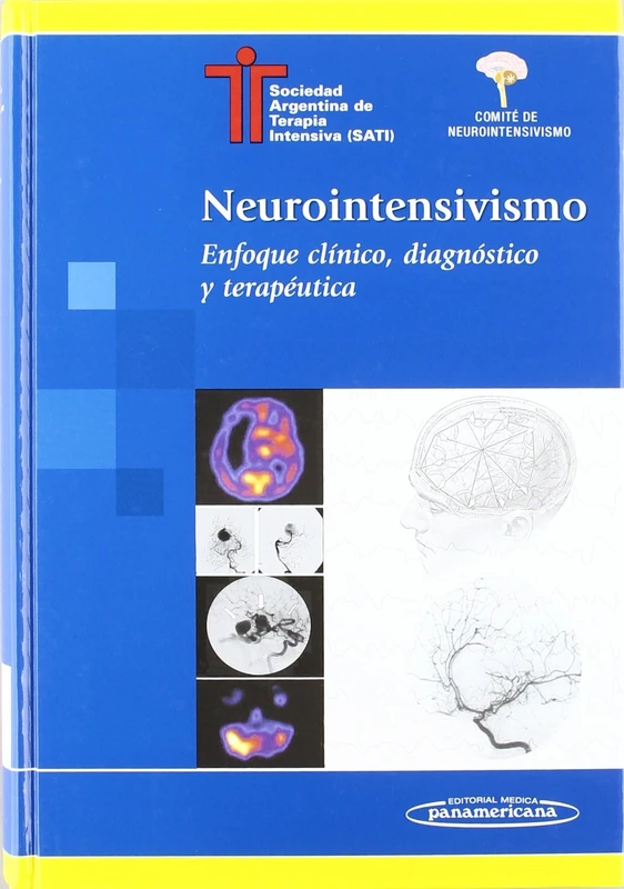 Neurointensivismo / Neuro-Intensive: Enfoque Clinico, Diagnostico Y Terapeutica / Clinical Approach, Diagnostic and Therapeutic