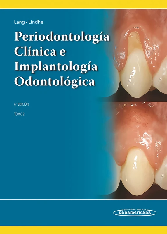 Periodontología Clínica e Implantología Odontológica: Tomo 2