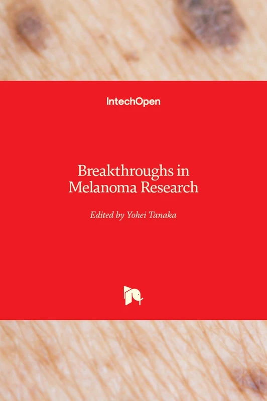Breakthroughs in Melanoma Research