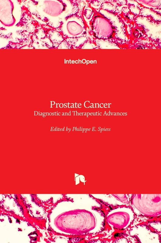 IntechOpen Prostate Cancer - Diagnostic and Therapeutic Advances