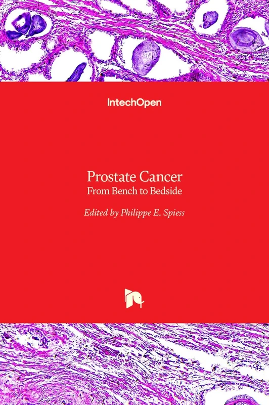 Prostate Cancer - From Bench to Bedside