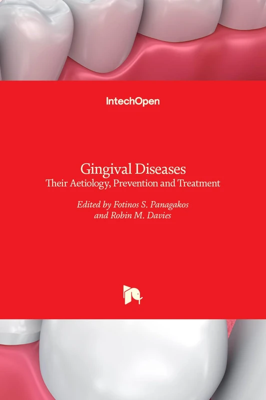 Gingival Diseases - Their Aetiology, Prevention and Treatment