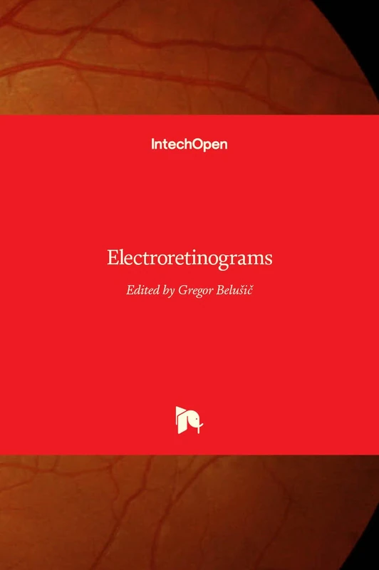 Electroretinograms