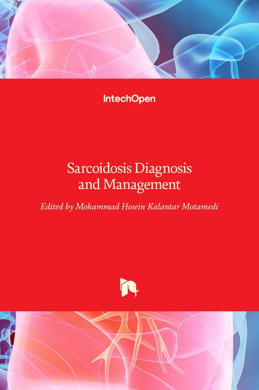 Sarcoidosis Diagnosis and Management