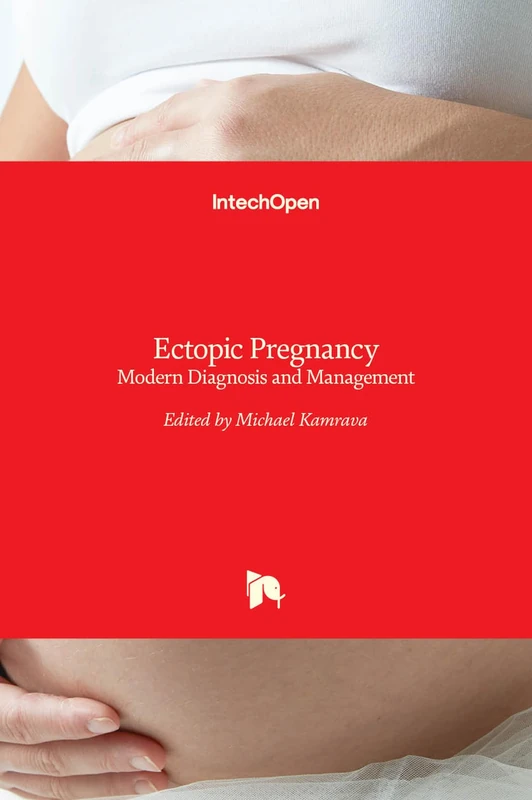 Ectopic Pregnancy - Modern Diagnosis and Management
