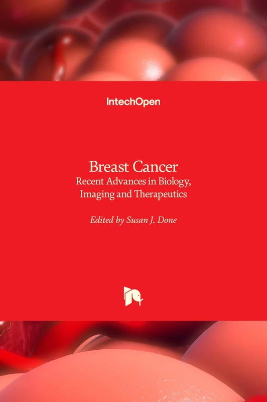IntechOpen Breast Cancer - Biology, Imaging and Therapeutics