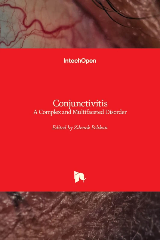 Conjunctivitis - A Complex and Multifaceted Disorder - Image 1