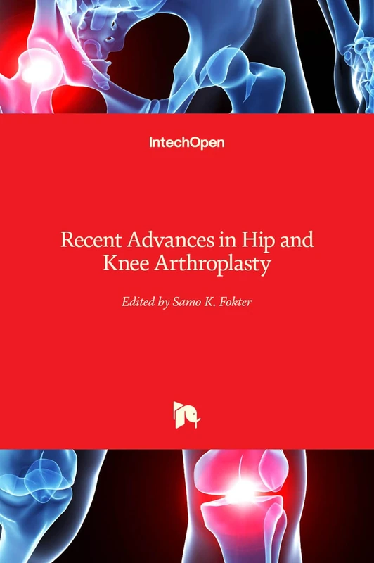 IntechOpen - Recent Advances in Hip and Knee Arthroplasty