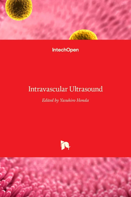 Intravascular Ultrasound