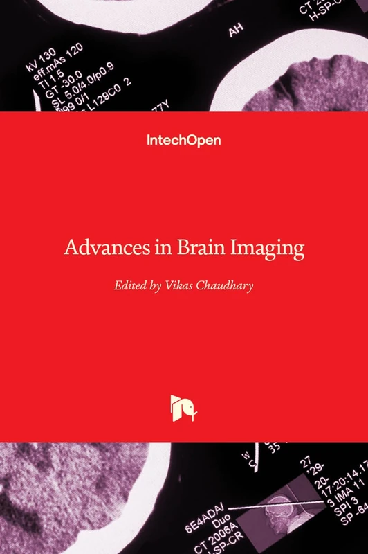 Advances in Brain Imaging