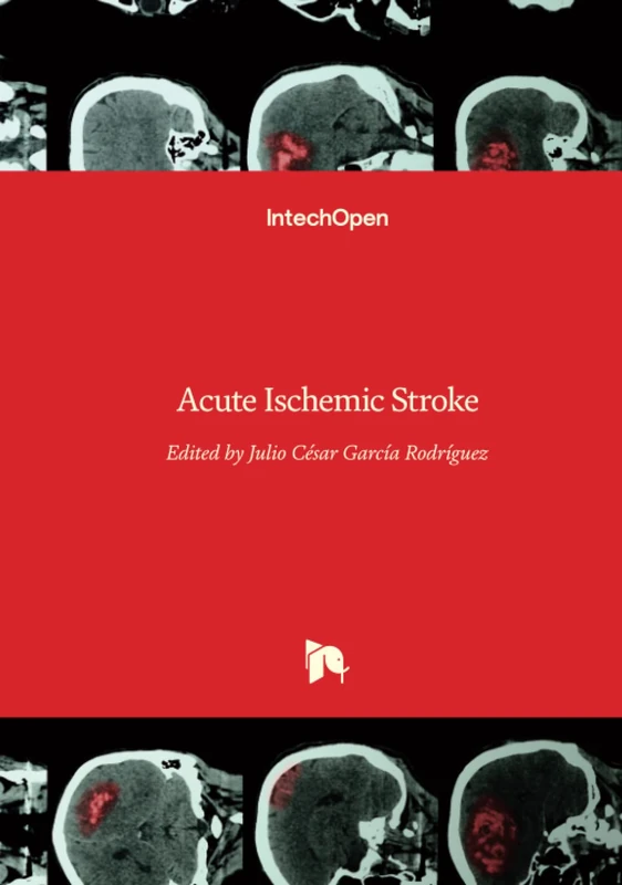 Acute Ischemic Stroke