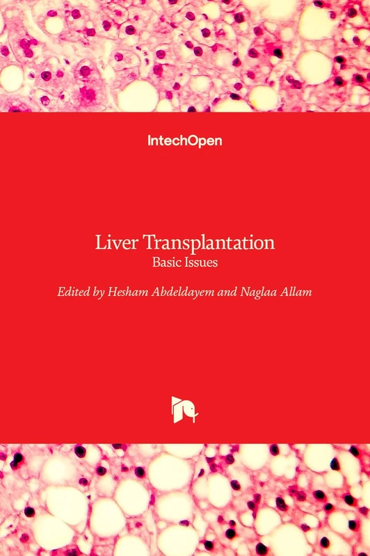 Liver Transplantation - Basic Issues
