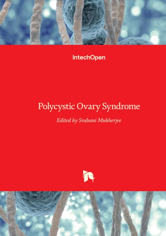 Polycystic Ovary Syndrome - Image 1