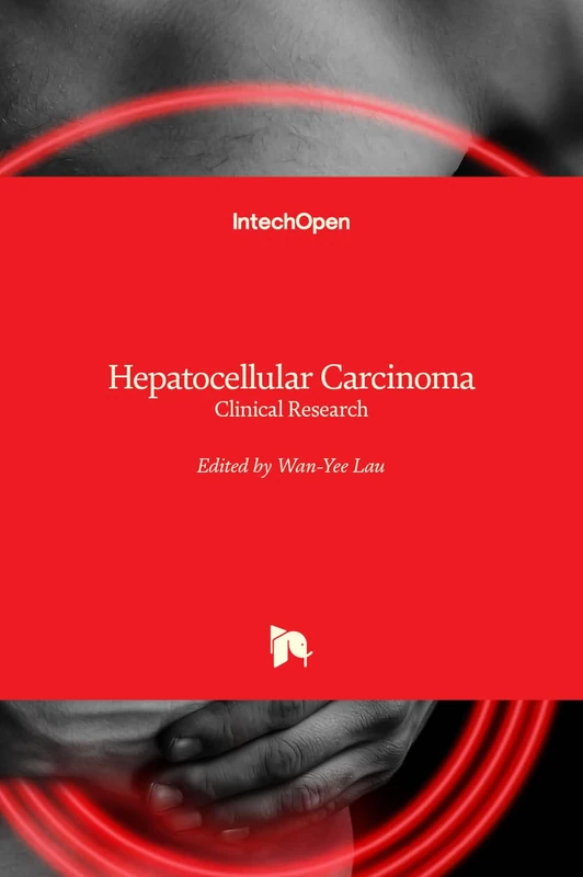 IntechOpen Hepatocellular Carcinoma - Clinical Research Book