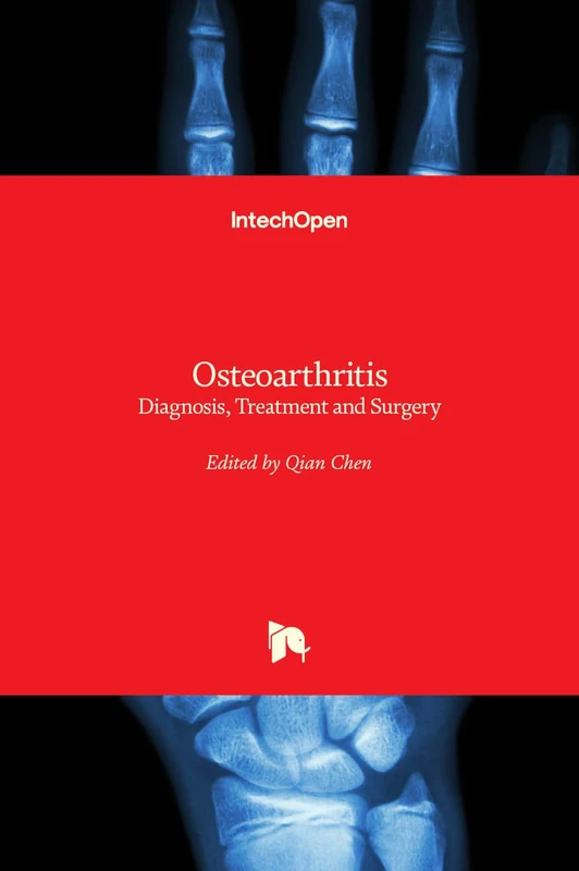 IntechOpen Osteoarthritis - Diagnosis, Treatment and Surgery