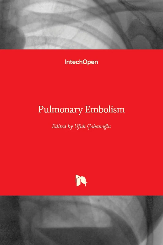 Pulmonary Embolism