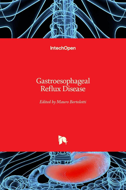 Gastroesophageal Reflux Disease