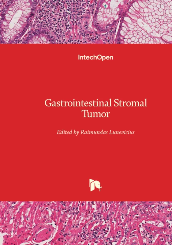 Gastrointestinal Stromal Tumor