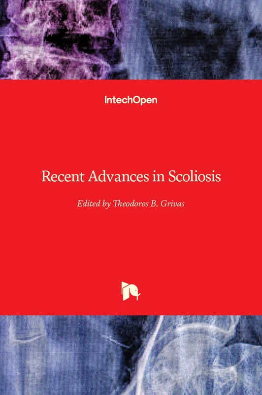 IntechOpen Recent Advances in Scoliosis - Medical Book