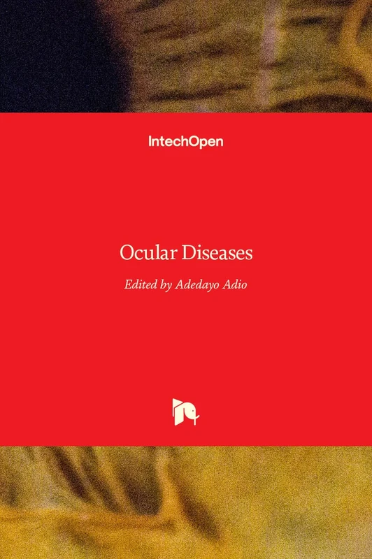 Ocular Diseases