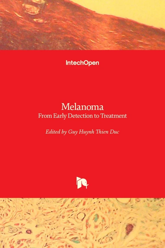 Melanoma: From Early Detection to Treatment