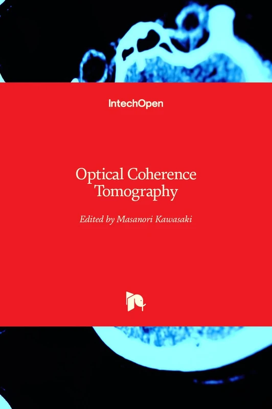 Optical Coherence Tomography