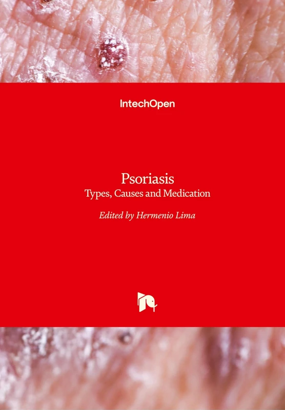 Psoriasis: Types, Causes and Medication