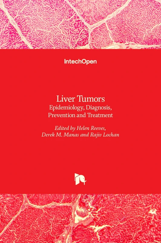 Liver Tumors: Epidemiology, Diagnosis, Prevention and Treatment