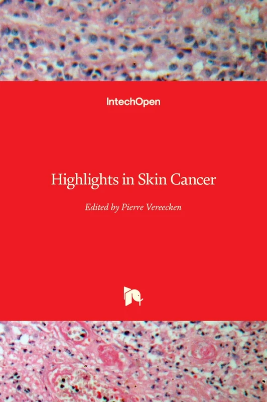 IntechOpen Highlights in Skin Cancer - Medical Oncology Book