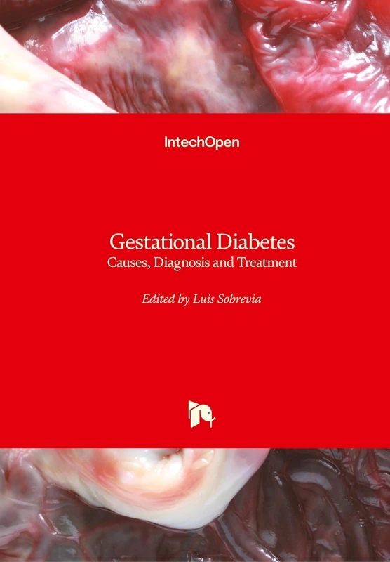 Gestational Diabetes: Causes, Diagnosis and Treatment