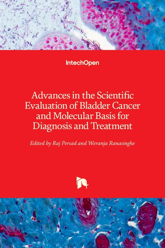 Advances in the Scientific Evaluation of Bladder Cancer and Molecular Basis for Diagnosis and Treatment