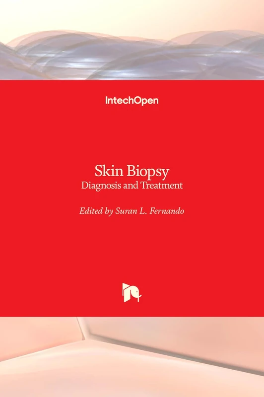 Skin Biopsy: Diagnosis and Treatment