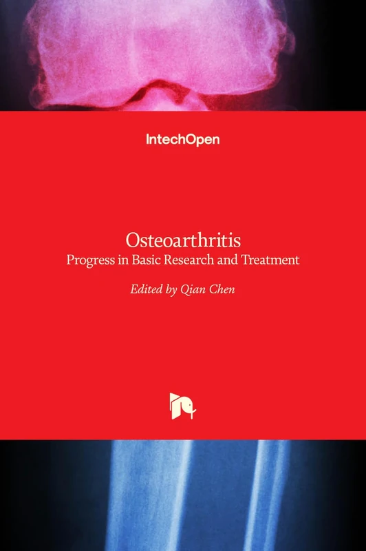 Osteoarthritis: Progress in Basic Research and Treatment