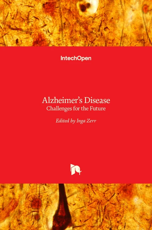 IntechOpen Alzheimer's Disease: Challenges for the Future