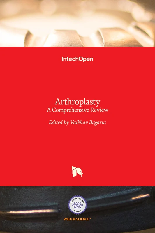 Arthroplasty - A Comprehensive Review